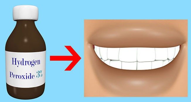 670px-Get-Whiter-Teeth-at-H