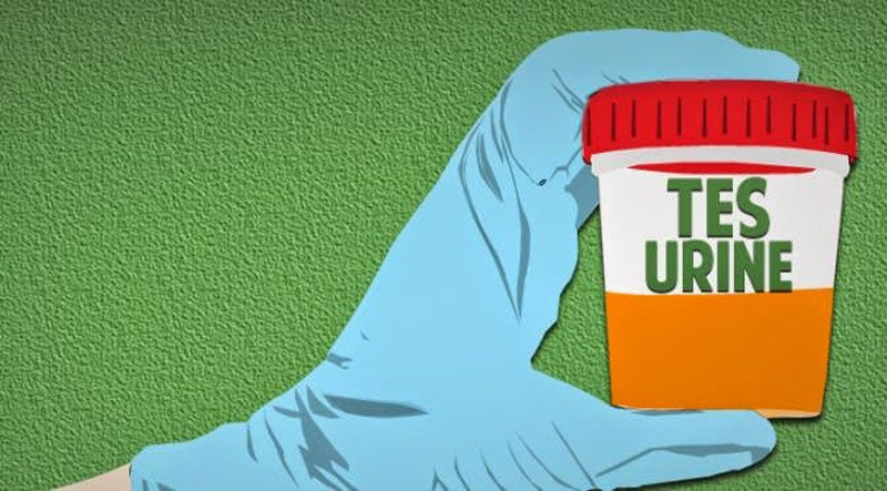tes-urine